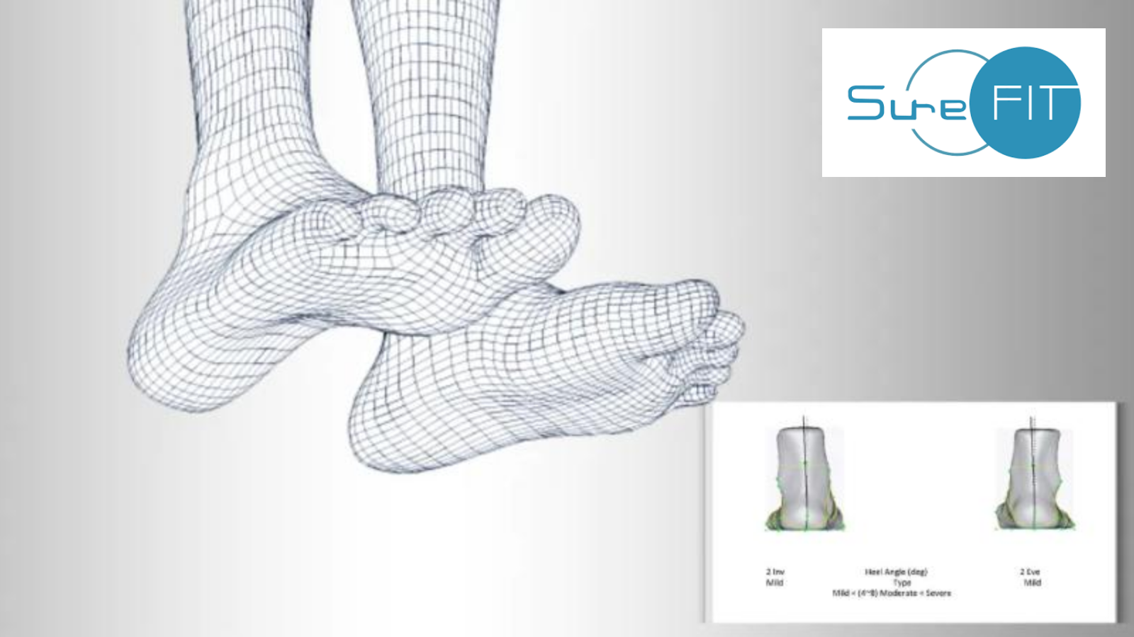 SureFIT