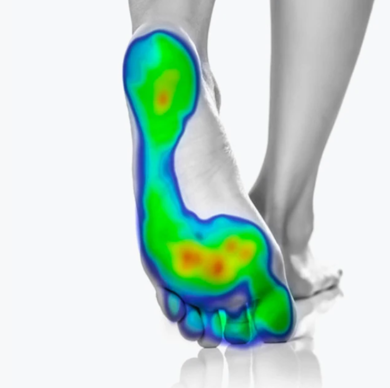 FOOTSCAN